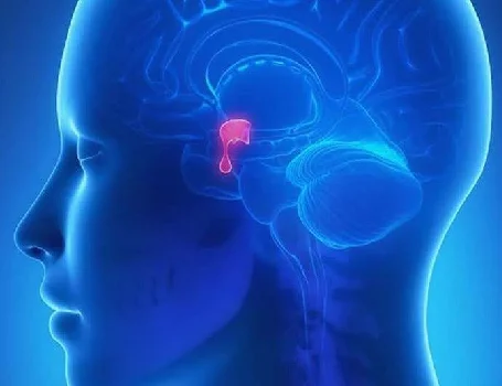 Entendiendo los Aneurismas Cerebrales: Información Importante para Pacientes