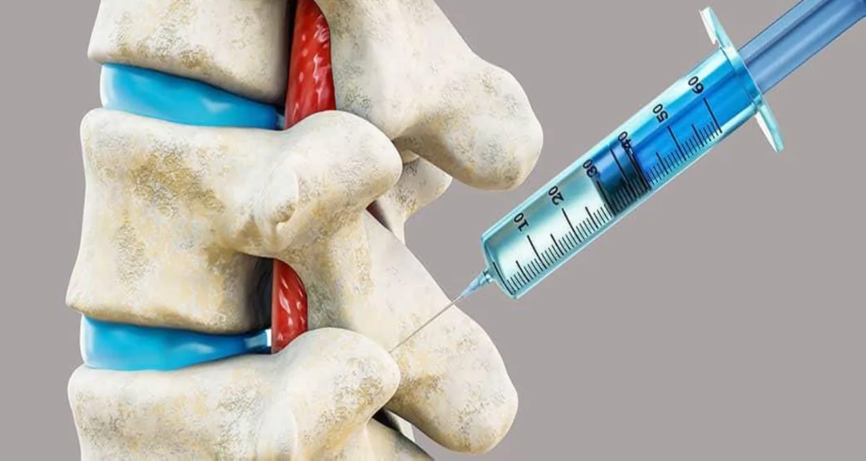 ¿Qué es el Dolor Facetario y Cómo Puedes Controlarlo?