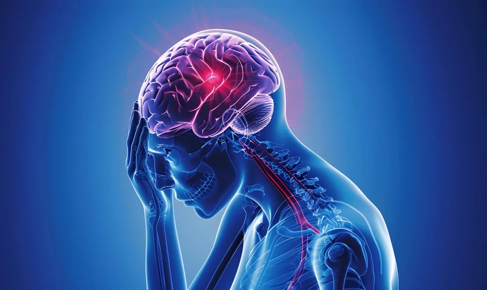 Accidentes Cerebrovasculares